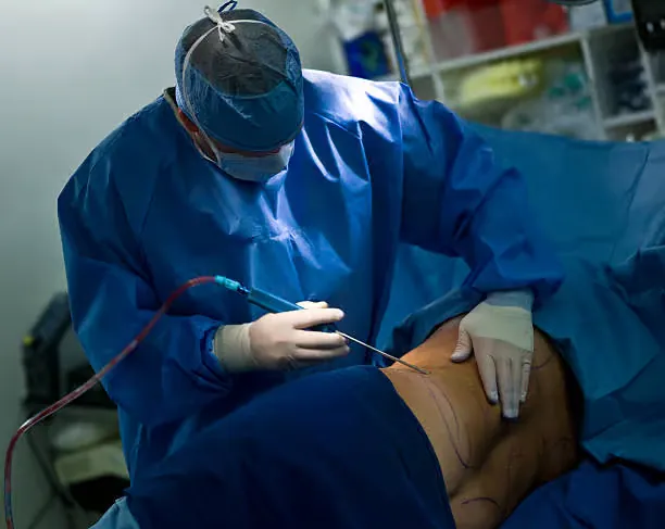 Consultant surgeon performing VASER liposuction in the operating theatre